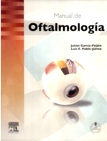 Manual de Oftalmología