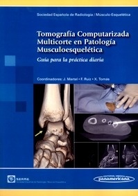 Tomografía Computerizada Multicorte en Patología Musculoesquelética "Guía para la Práctica Diaria"