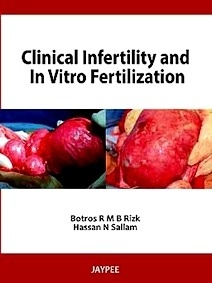 Clinical Infertility And In Vitro Fertilization