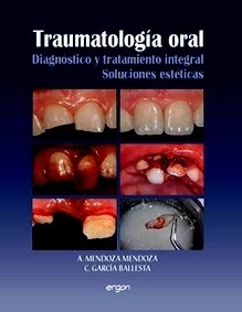 Traumatología Oral "Diagnóstico y Tratamiento Integral Soluciones Estéticas"