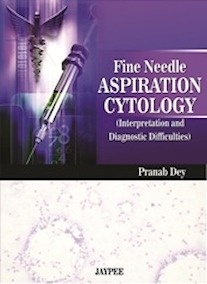 Fine Needle Aspiration Cytology "Interpretation and Diagnostic Difficulties"