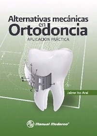 Alternativas Mecánicas en Ortodoncia "Aplicación Práctica"