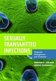 Sexually Transmitted Infections "Diagnosis, Management, and Treatment"