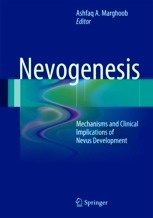 Nevogenesis "Mechanisms and Clinical Implications of Nevus Development"