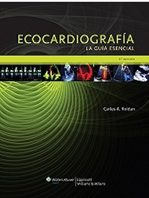 Ecocardiografía "La Guía Esencial"