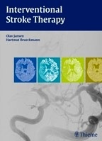 Interventional Stroke Therapy