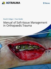AO Manual Of Soft-Tissue Management In Orthopaedic Trauma