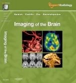 Imaging of the Brain