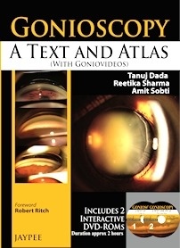 Gonioscopy: A Text and Atlas "(with Goniovideos)"