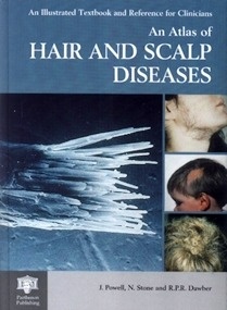 An Atlas of Hair and Scalp Diseases