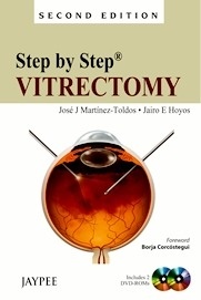 Step by Step: Vitrectomy