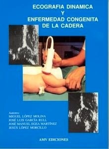 Ecografia Dinamica y Enfermedad Congenita de Cadera