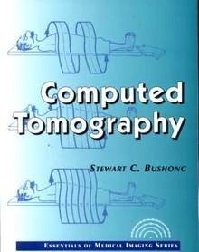 Computed Tomography "Essentials Of Medical Imaging Series"