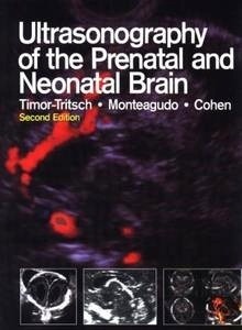 Ultrasonography of the Prenatal and Neonatal Brain
