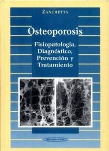 Osteoporosis. "Fisiopatología, Diagnóstico, Prevención y Tratamiento"