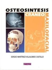 Osteosintesis Craneo Maxilofacial