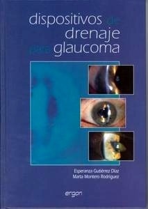 Dispositivos de Drenaje para Glaucoma