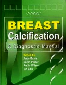 Breast Calcification "a Diagnostic Manual"