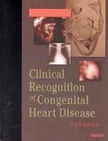 Clinical Recognition Of Congenital Heart Disease
