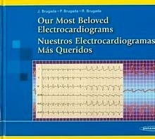 Nuestros Electrocardiogramas Más Queridos