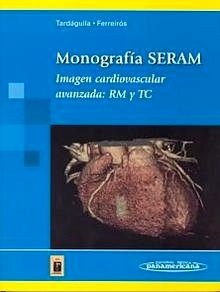 Imagen Cardiovascular Avanzada: Rm y Tc "Monografía Seram."