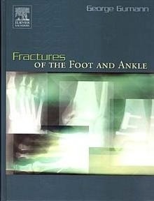 Fractures Of The Foot And Ankle