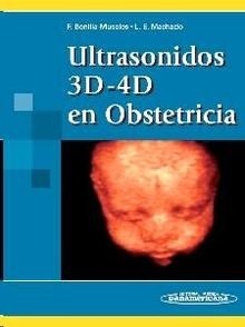 Ultrasonidos 3d - 4d en Obstetricia
