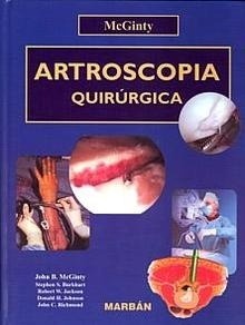 Artroscopia Quirúrgica