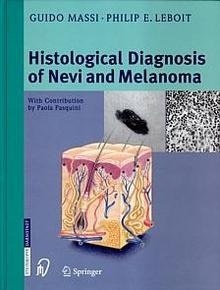 The Histological Diagnosis of Nevi and Melanoma