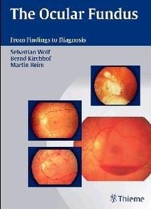 The Ocular Fundus "from Findings to Diagnosis"