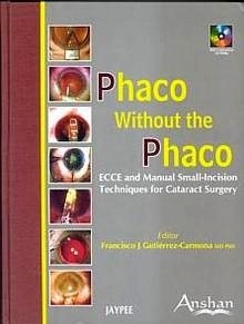 Phaco Without the Phaco + 2 Cd-Rom "ECCE and Manual Small-Incision Techniques for Cataract Surgery"