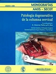 Patologia Degenerativa de la Columna Cervical Tomo 1 Vol.2005 "Monografias AAOS - SECOT"