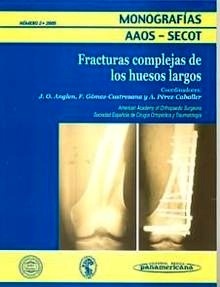 Fracturas Complejas de los Huesos Largos Tomo 2 Vol.2005 "Monografias AAOS - SECOT"