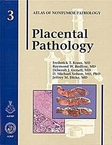 Placental Pathology.  Vol. 3 "Atlas Of Nontumor Pathology."
