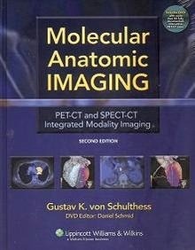Molecular Anatomic Imaging 2/e (PET-CT and SPECT-CT Integrated Modality Imaging