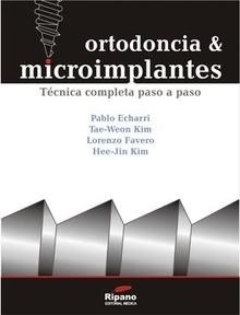 Ortodoncia y Microimplantes. Técnica Completa Paso a Paso