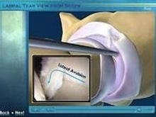 Hip Arthroscopy. Formato CD-ROM "Surgical Techniques and Pitfalls"