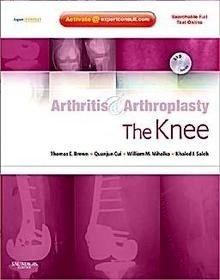 Arthritis And Arthroplasty. The Knee + Dvd