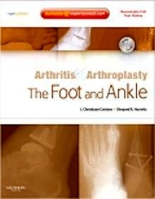 Arthritis And Arthroplasty: The Foot And Ankle "Expert Consult - Online, Print And Dvd"