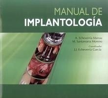 Manual de Implantología