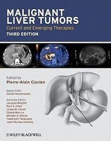 Malignant Liver Tumors "Current And Emerging Therapies"