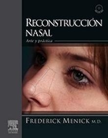 Reconstrucción Nasal + Dvd-Rom