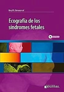 Ecografía de los Síndromes Fetales + DVD