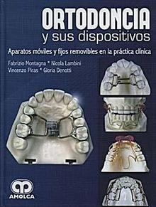 Ortodoncia y sus Dispositivos