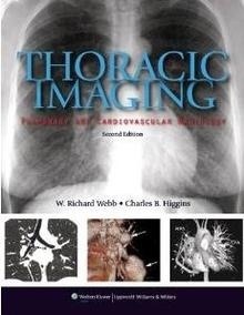 Thoracic Imaging: Pulmonary and Cardiovascular Radiology