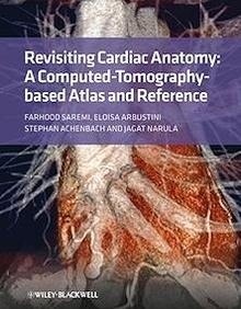 Revisiting Cardiac Anatomy: A Computed-Tomography Based Atlas and Reference