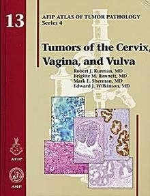 Tumors Of The Cervix Vagina And Vulva 13 "Atlas Of Tumor Pathology"