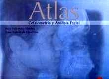 Atlas de Encefalometría y Análisis Facial