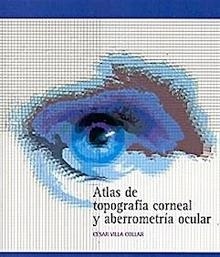 Atlas de Topografia Corneal y Aberrometria Ocular