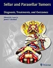 Sellar And Parasellar Tumors "Diagnosis, Treatments, And Outcomes"